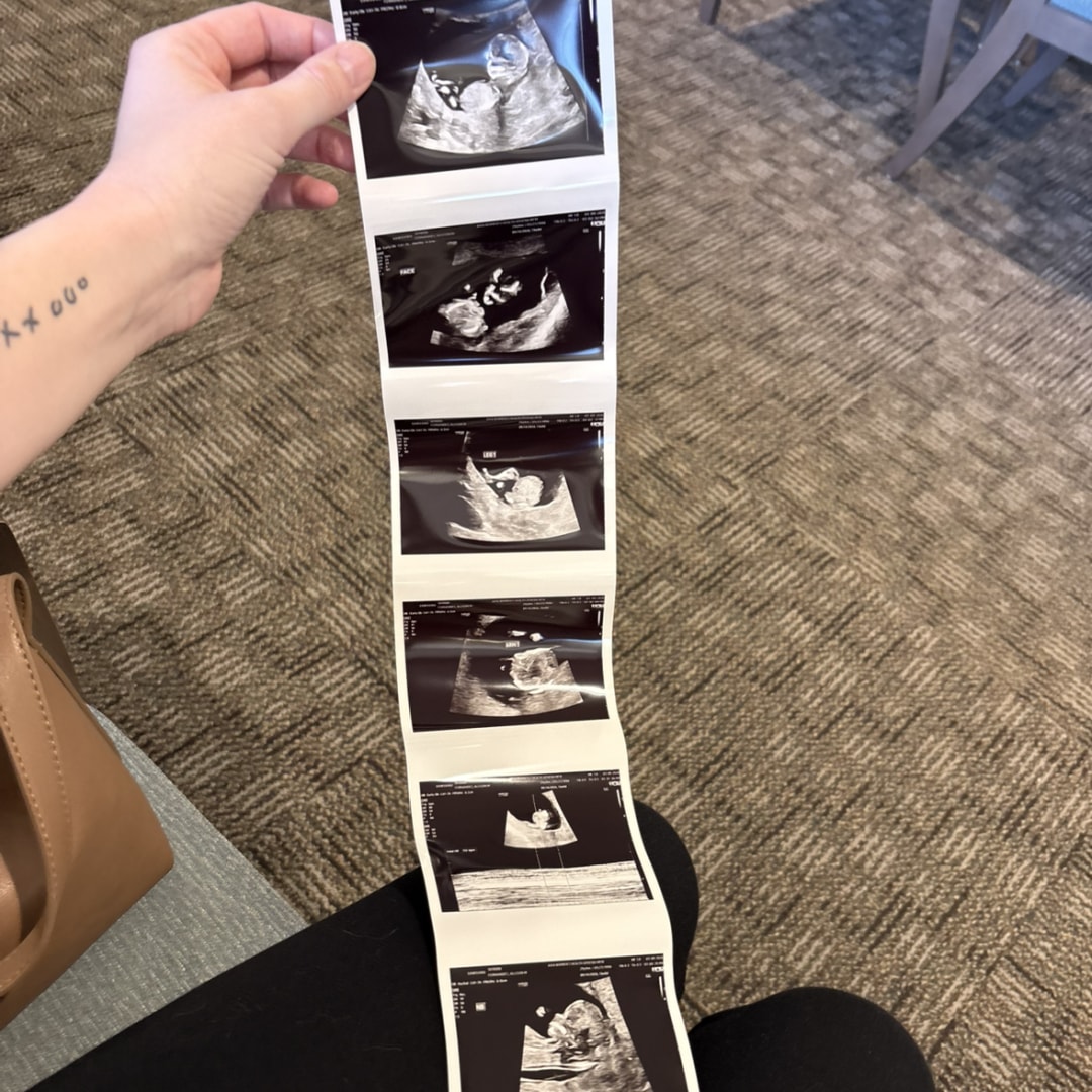 Photo shared by Allison for their Babylist baby registry.