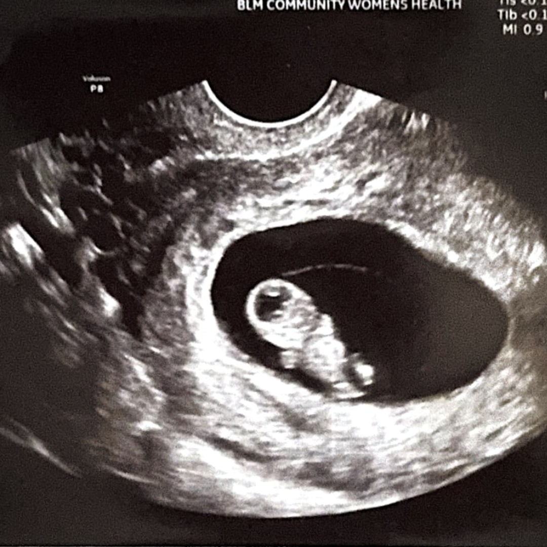 Photo shared by Kelly for their Babylist baby registry.