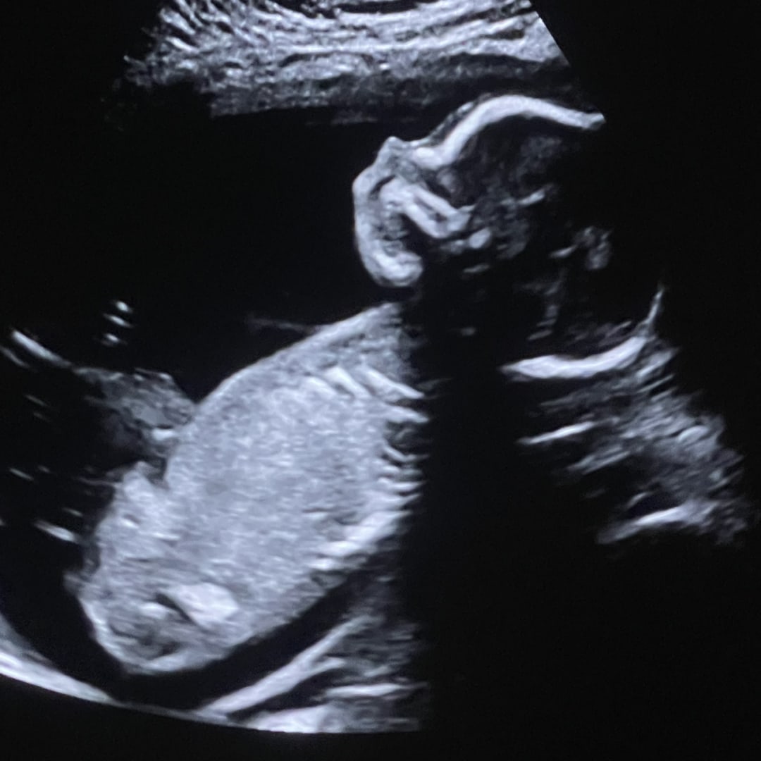 Photo shared by Brandi for their Babylist baby registry.