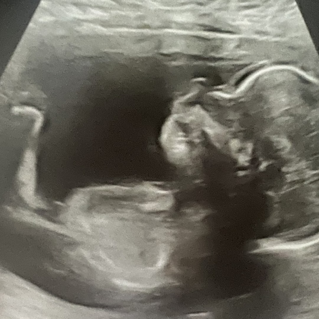 Photo shared by Christina for their Babylist baby registry.