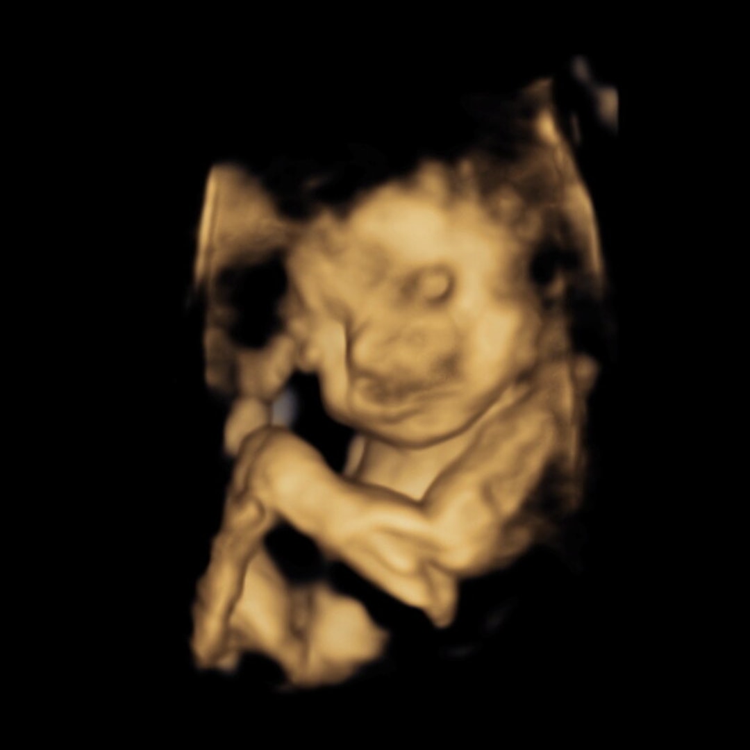 Photo shared by Iria for their Babylist baby registry.