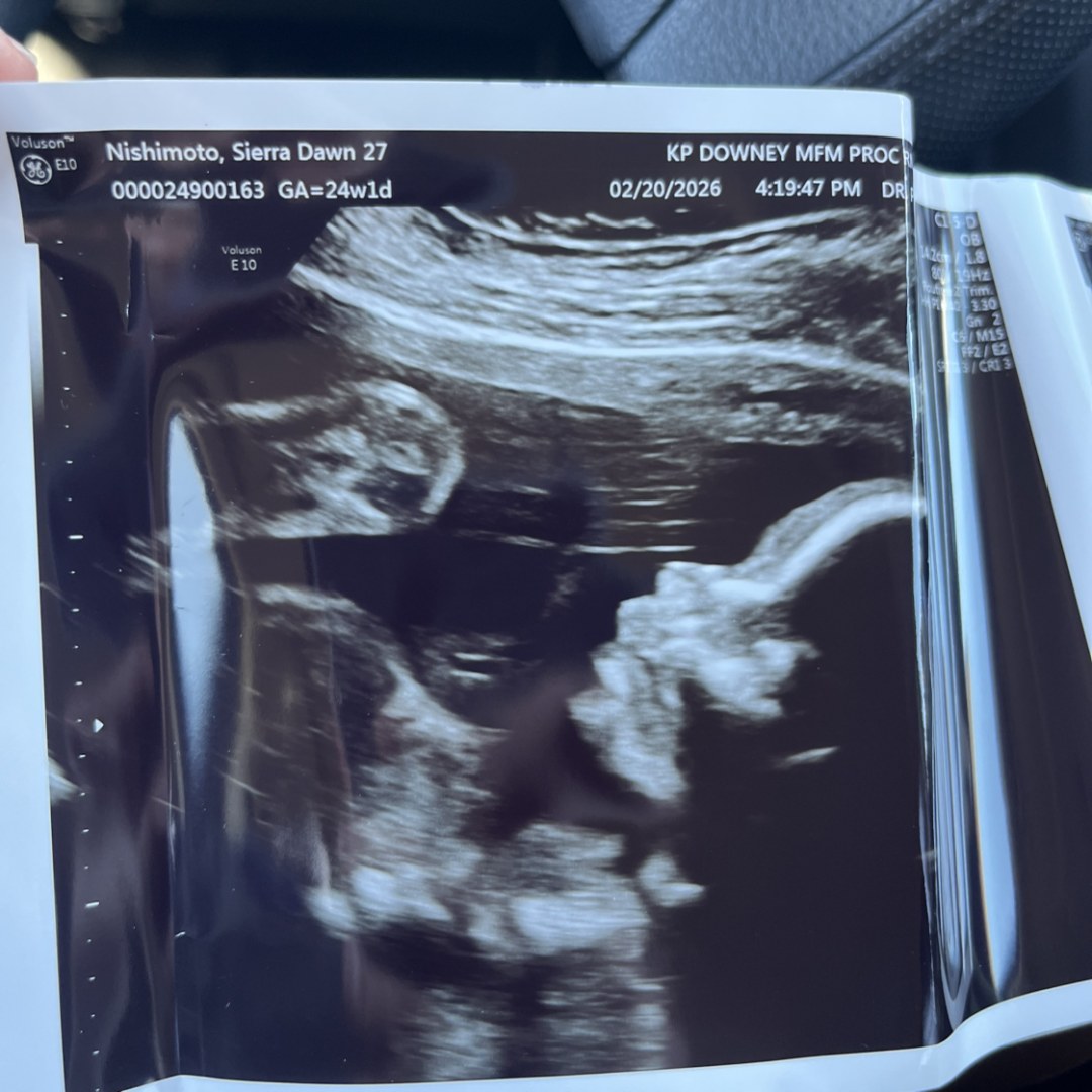 Photo shared by Sierra for their Babylist baby registry.