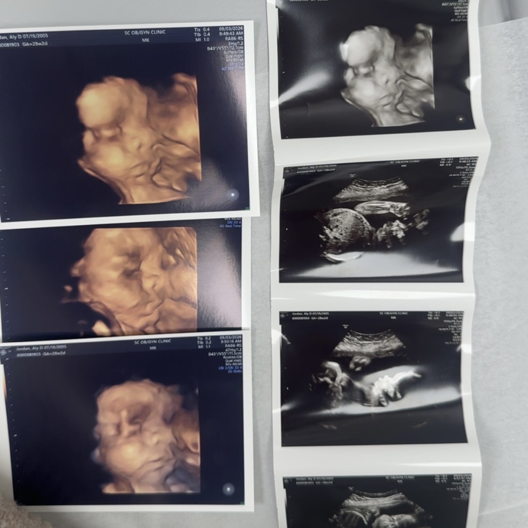 Photo shared by Aly for their Babylist baby registry.