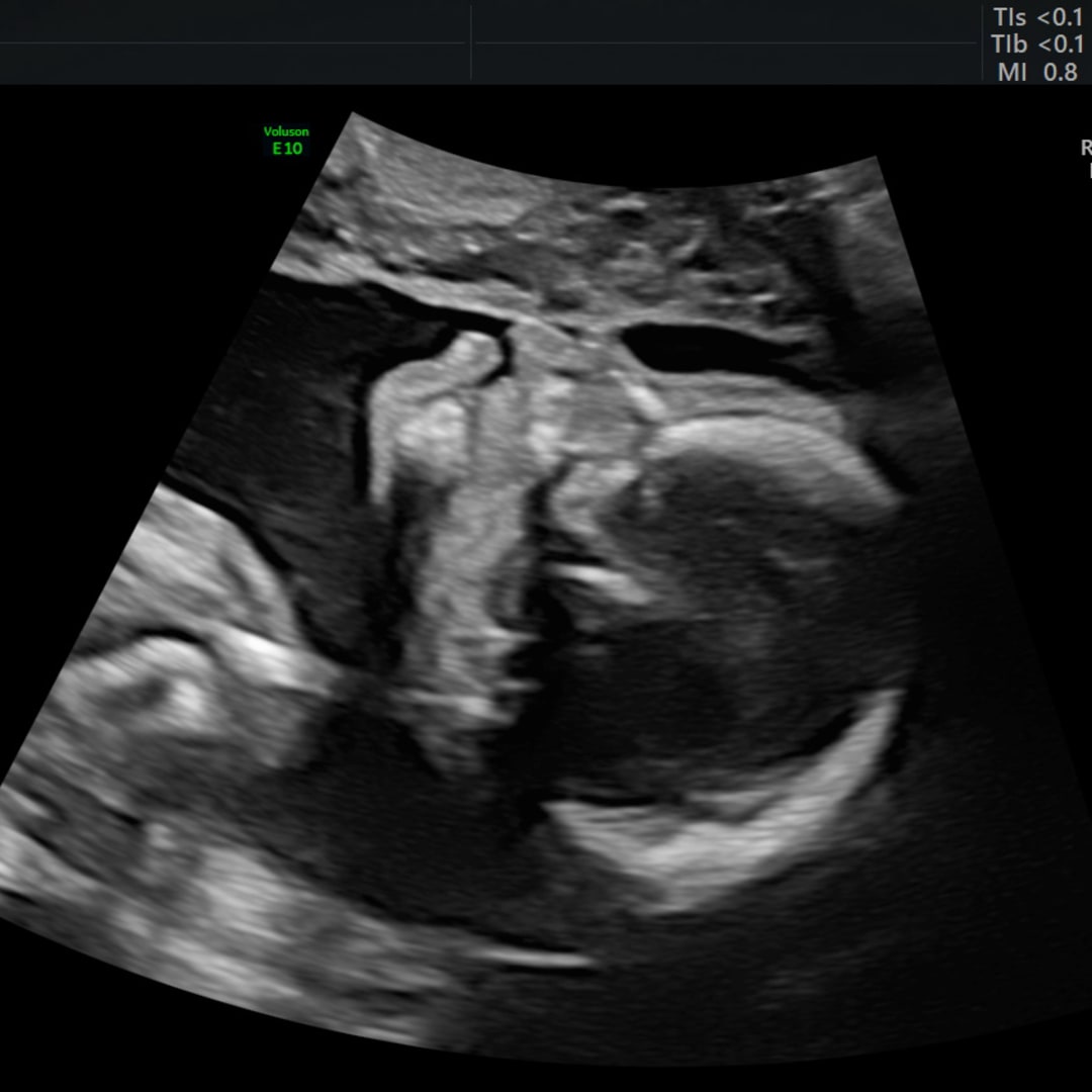 Photo shared by Cheyenne for their Babylist baby registry.