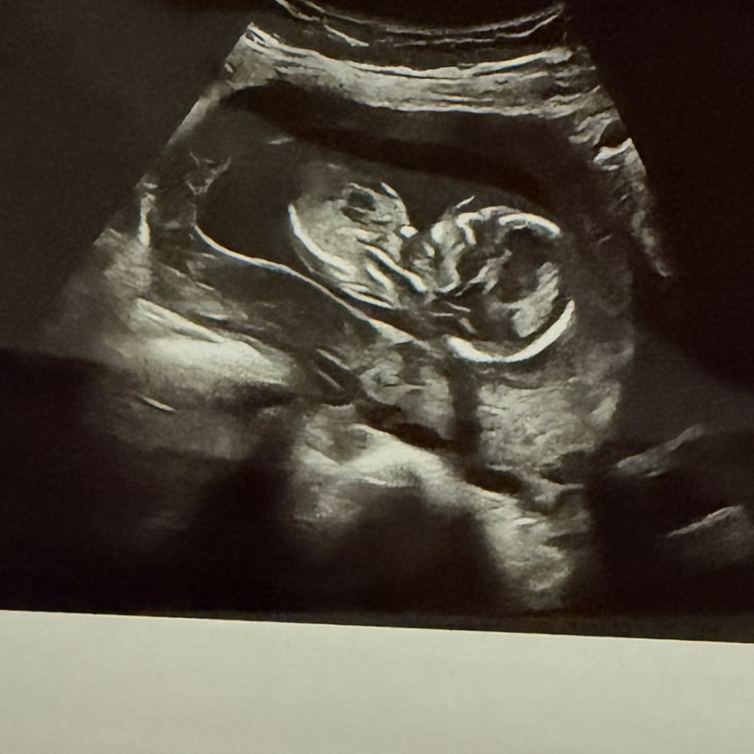 Photo shared by Mariah for their Babylist baby registry.