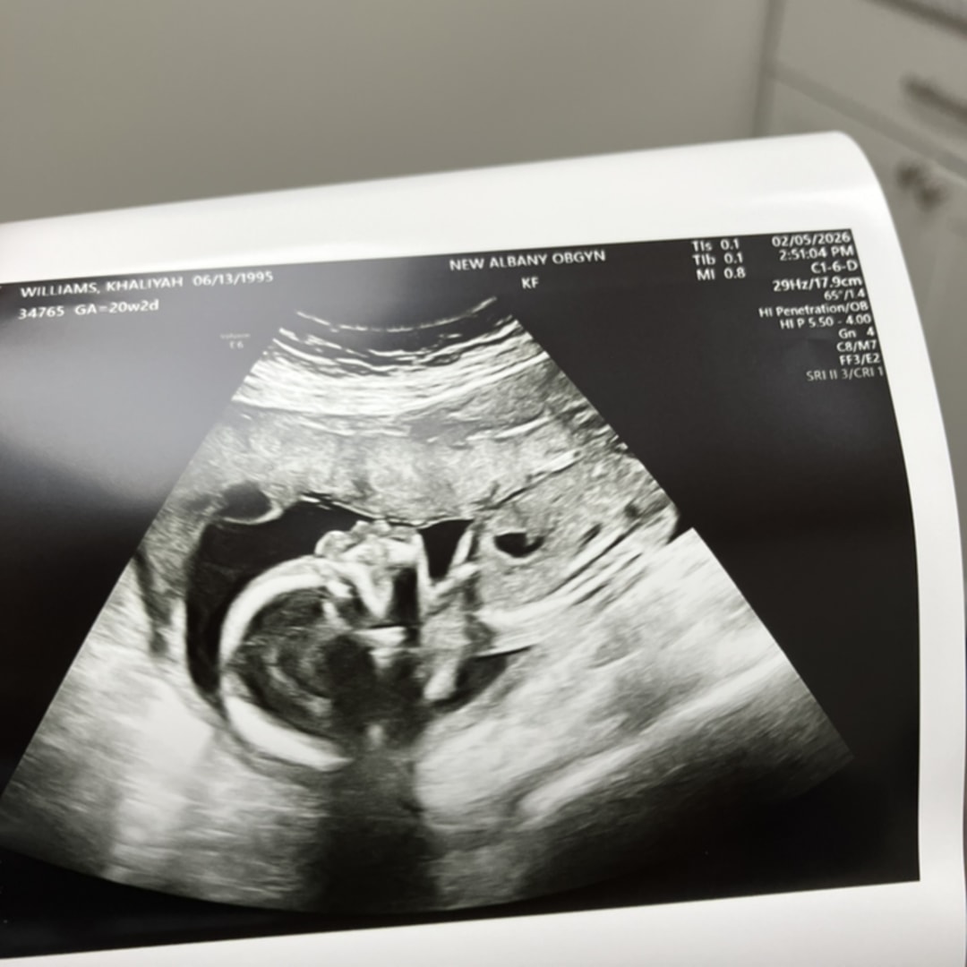 Photo shared by Khaliyah for their Babylist baby registry.