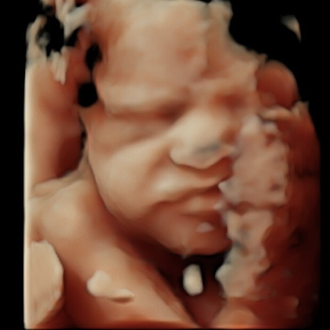 Photo shared by Caelin for their Babylist baby registry.