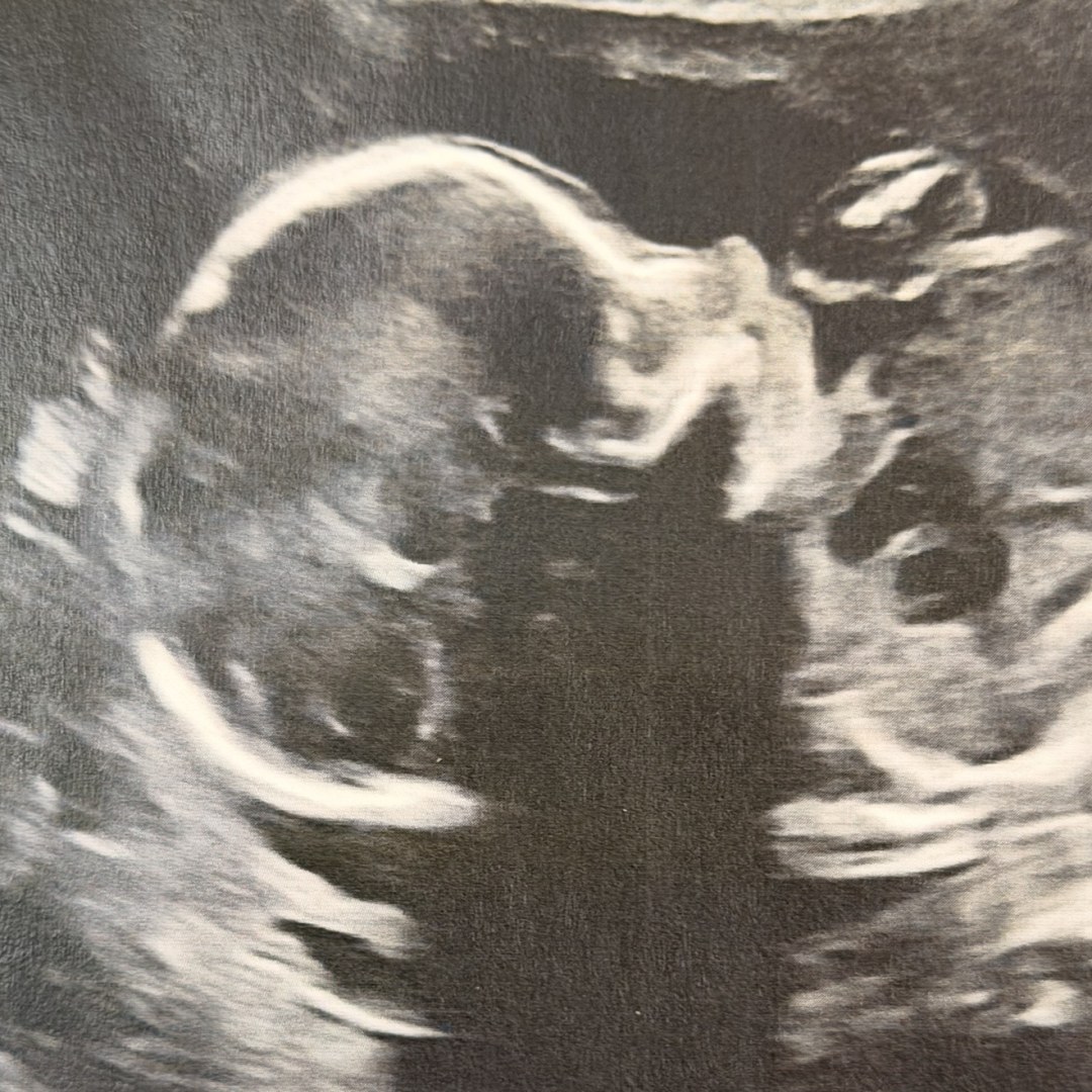 Photo shared by Catherine for their Babylist baby registry.