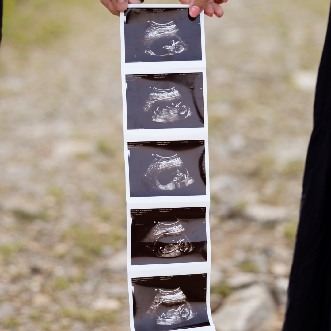 Photo shared by Madisyn for their Babylist baby registry.