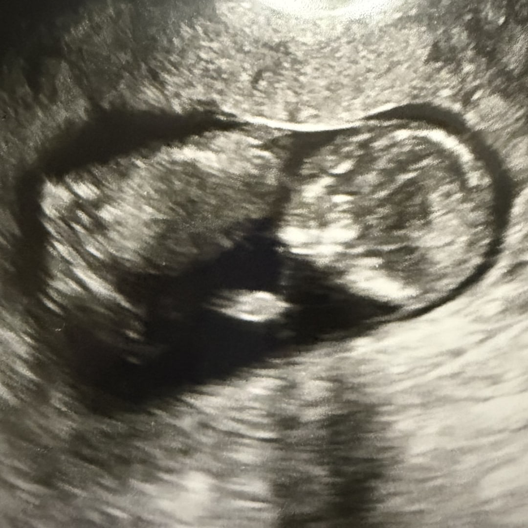 Photo shared by Nancy for their Babylist baby registry.