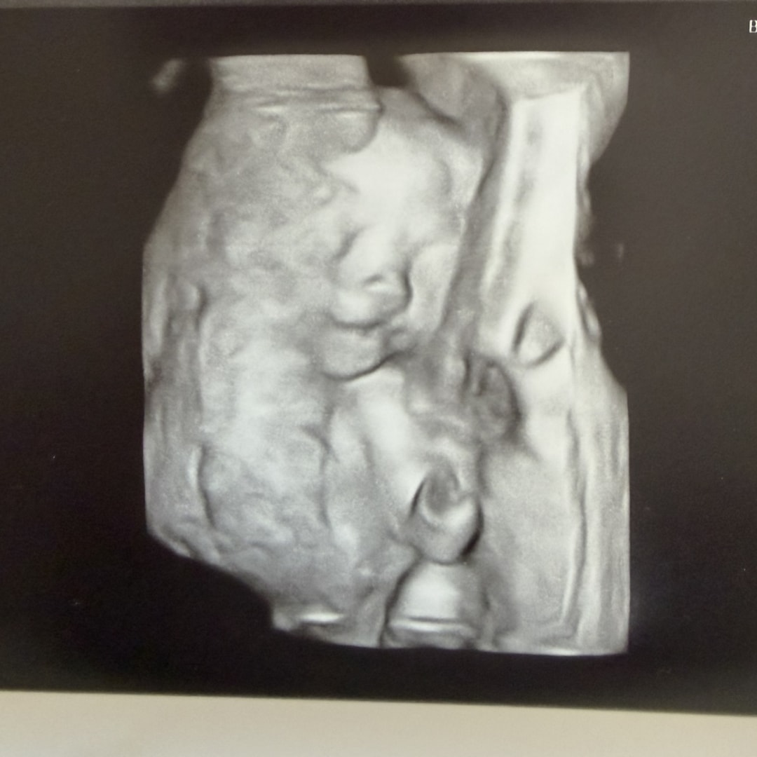 Photo shared by Alexis for their Babylist baby registry.