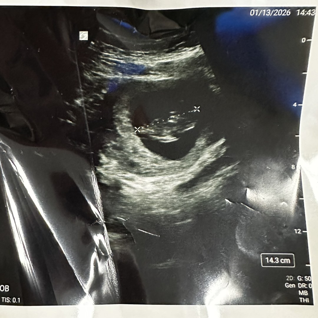 Photo shared by Kaitlyn for their Babylist baby registry.