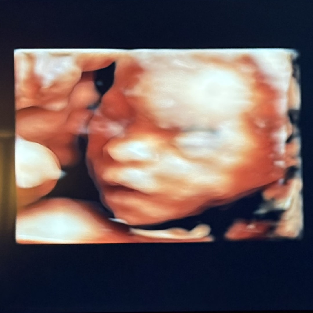 Photo shared by Sierra for their Babylist baby registry.