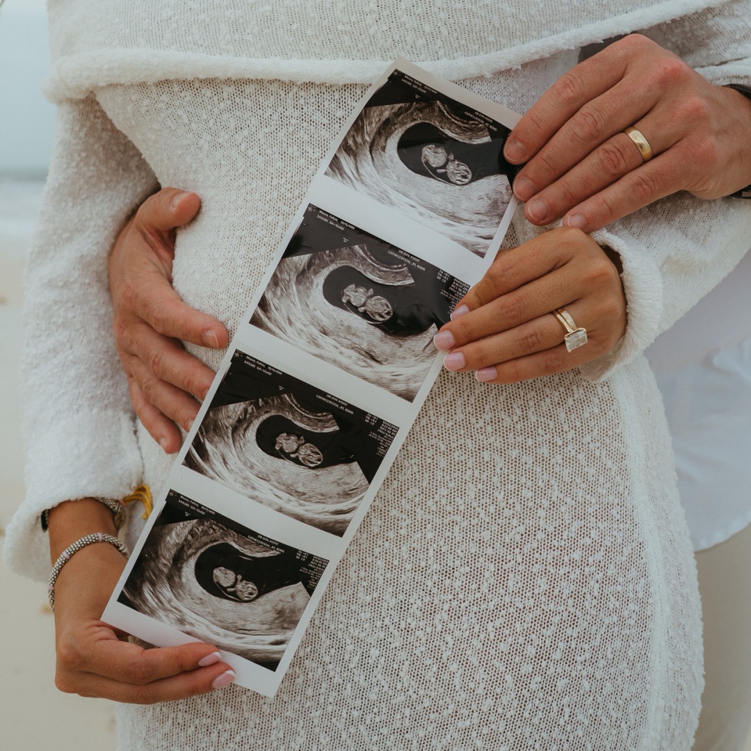 Photo shared by Felicia for their Babylist baby registry.