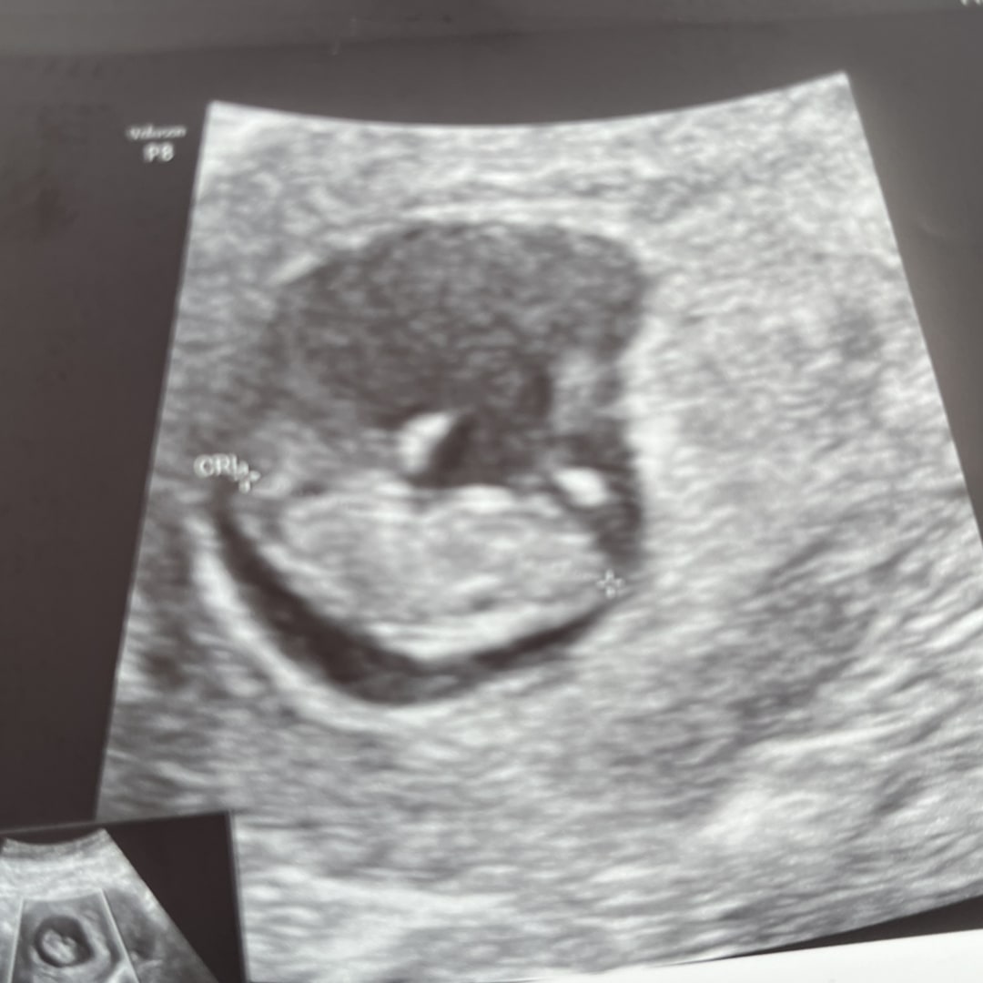 Photo shared by Adele for their Babylist baby registry.