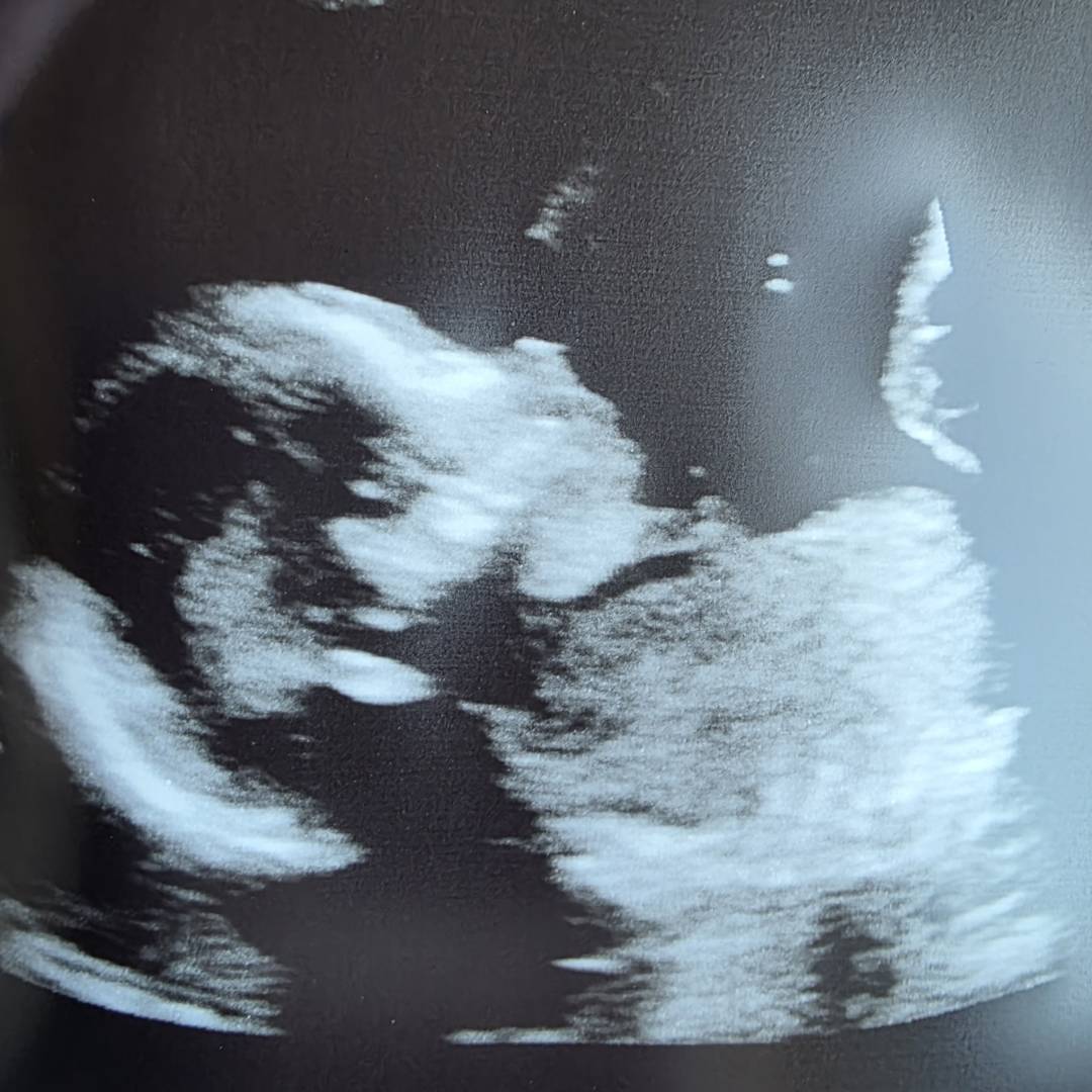 Photo shared by Samantha for their Babylist baby registry.