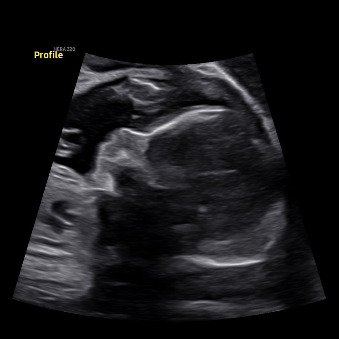 Photo shared by Christina for their Babylist baby registry.
