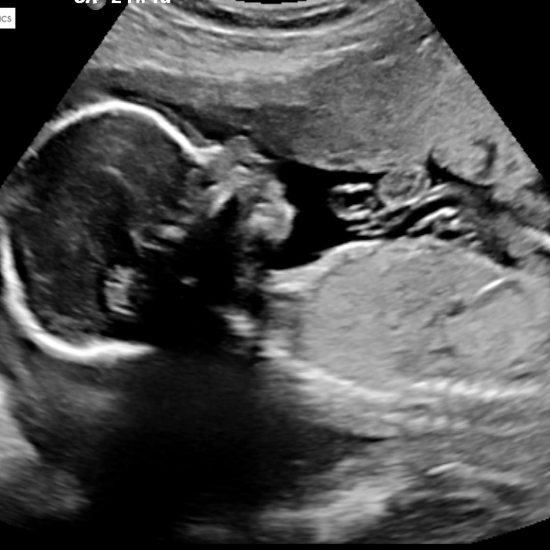 Photo shared by Nomar for their Babylist baby registry.
