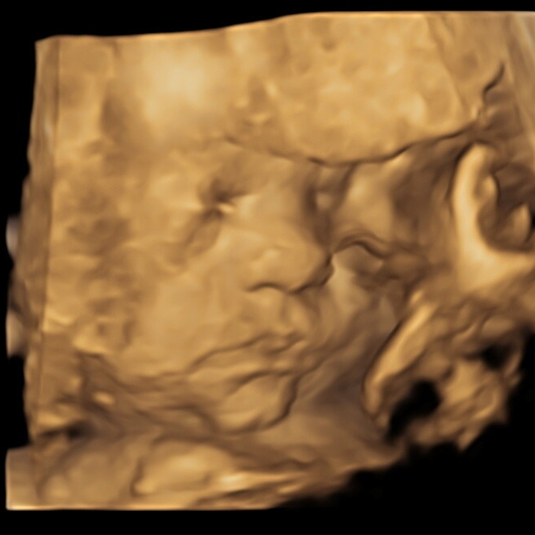 Photo shared by Jenny for their Babylist baby registry.