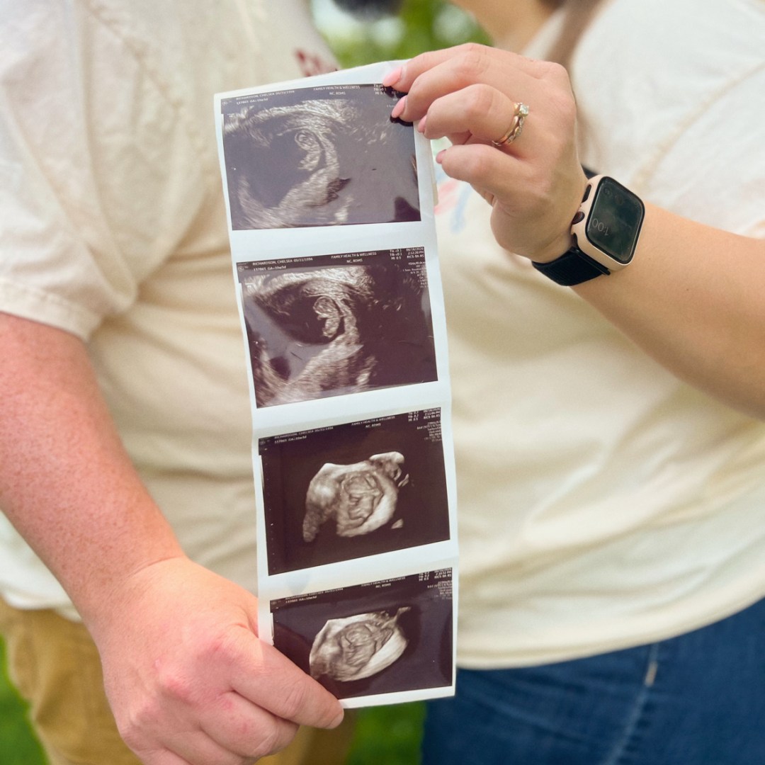 Photo shared by Chelsea for their Babylist baby registry.