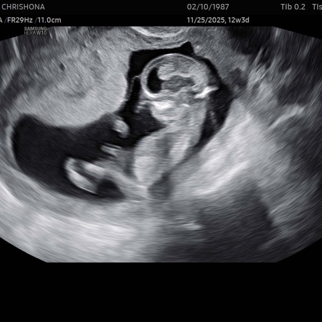 Photo shared by Chrishona for their Babylist baby registry.