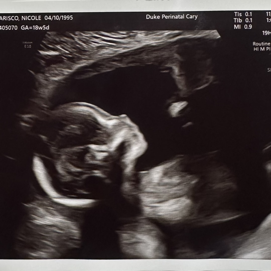 Photo shared by Nicole for their Babylist baby registry.