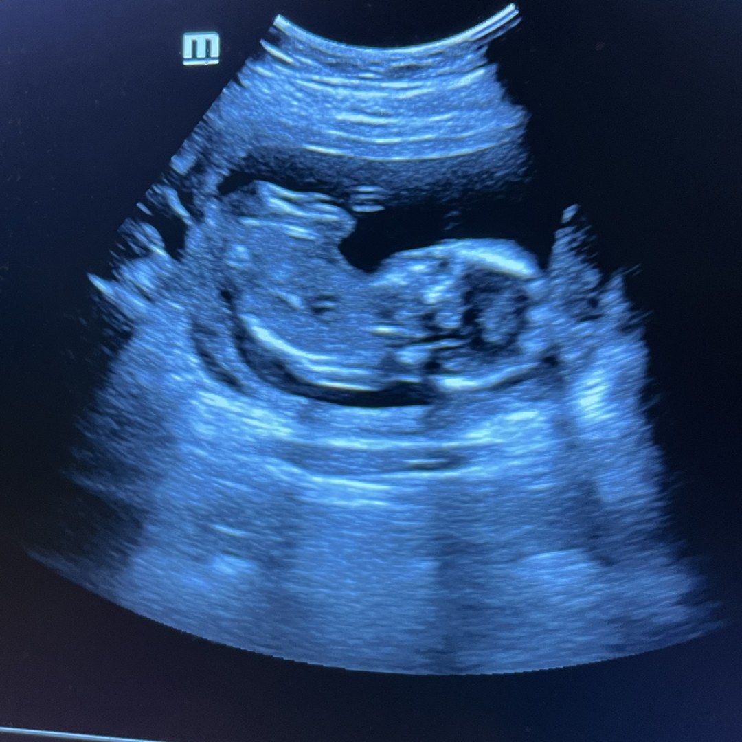 Photo shared by Haley for their Babylist baby registry.