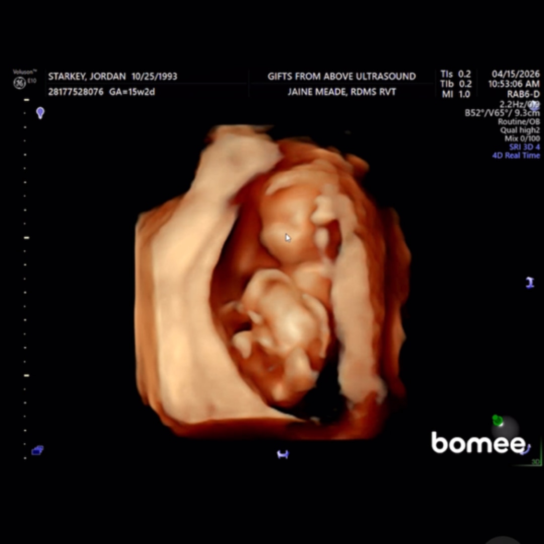 Photo shared by Jordan for their Babylist baby registry.