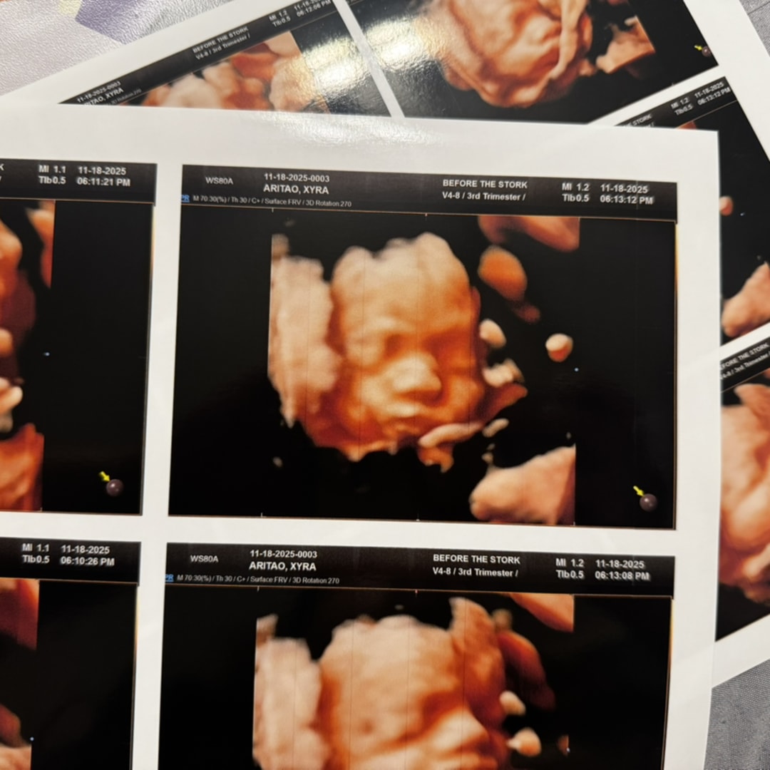 Photo shared by Xyra Lyn for their Babylist baby registry.