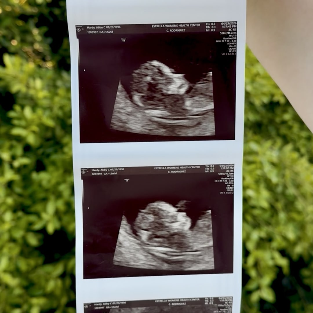Photo shared by Abby for their Babylist baby registry.