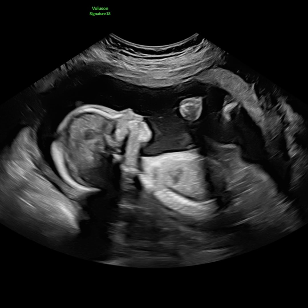 Photo shared by Ciera for their Babylist baby registry.