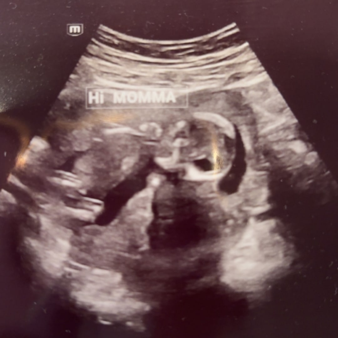 Photo shared by Bree for their Babylist baby registry.