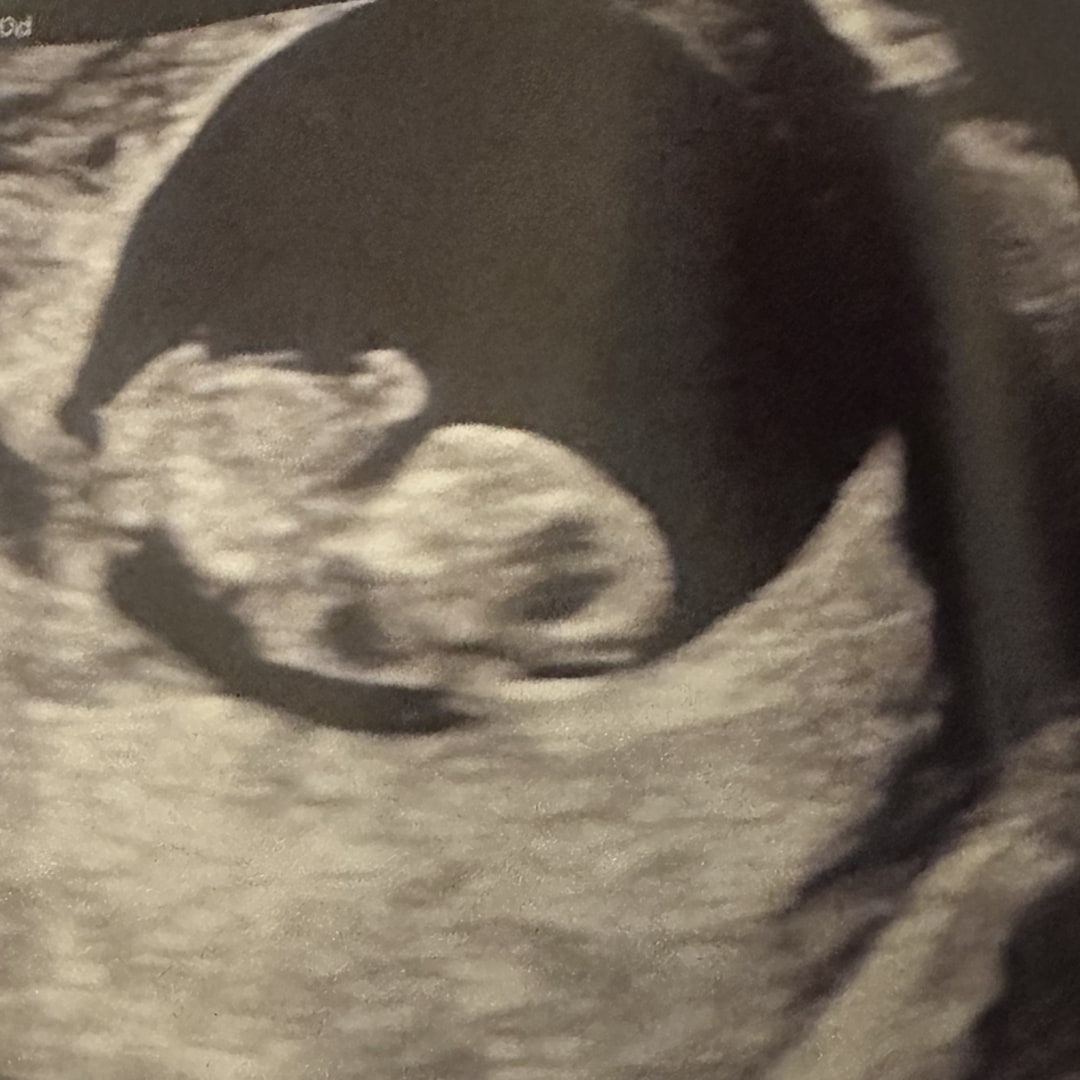 Photo shared by Laura for their Babylist baby registry.