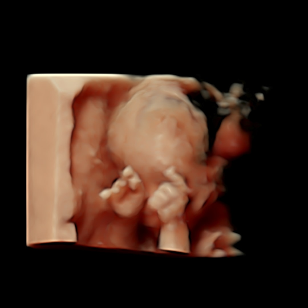 Photo shared by Laura for their Babylist baby registry.