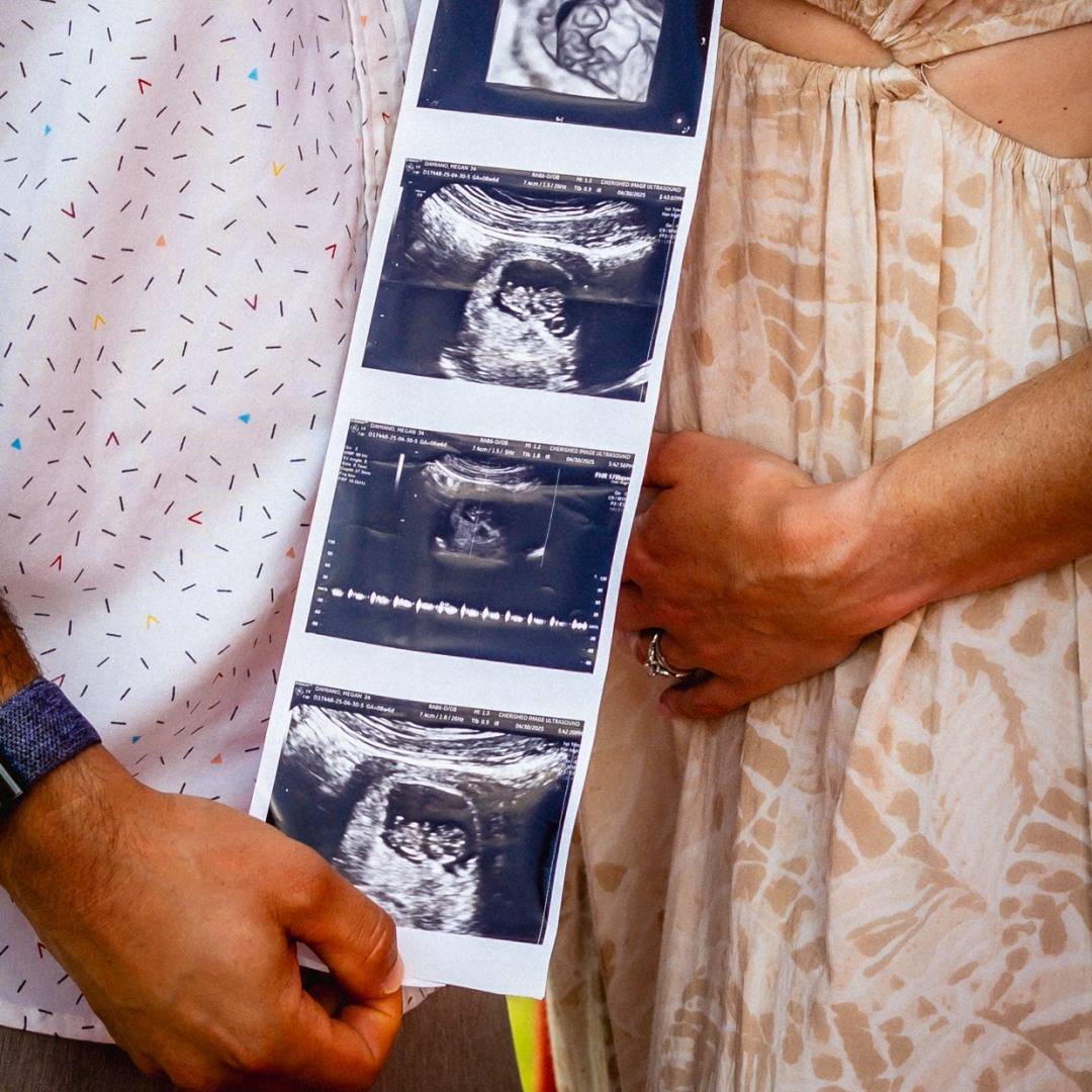 Photo shared by Fortunato for their Babylist baby registry.