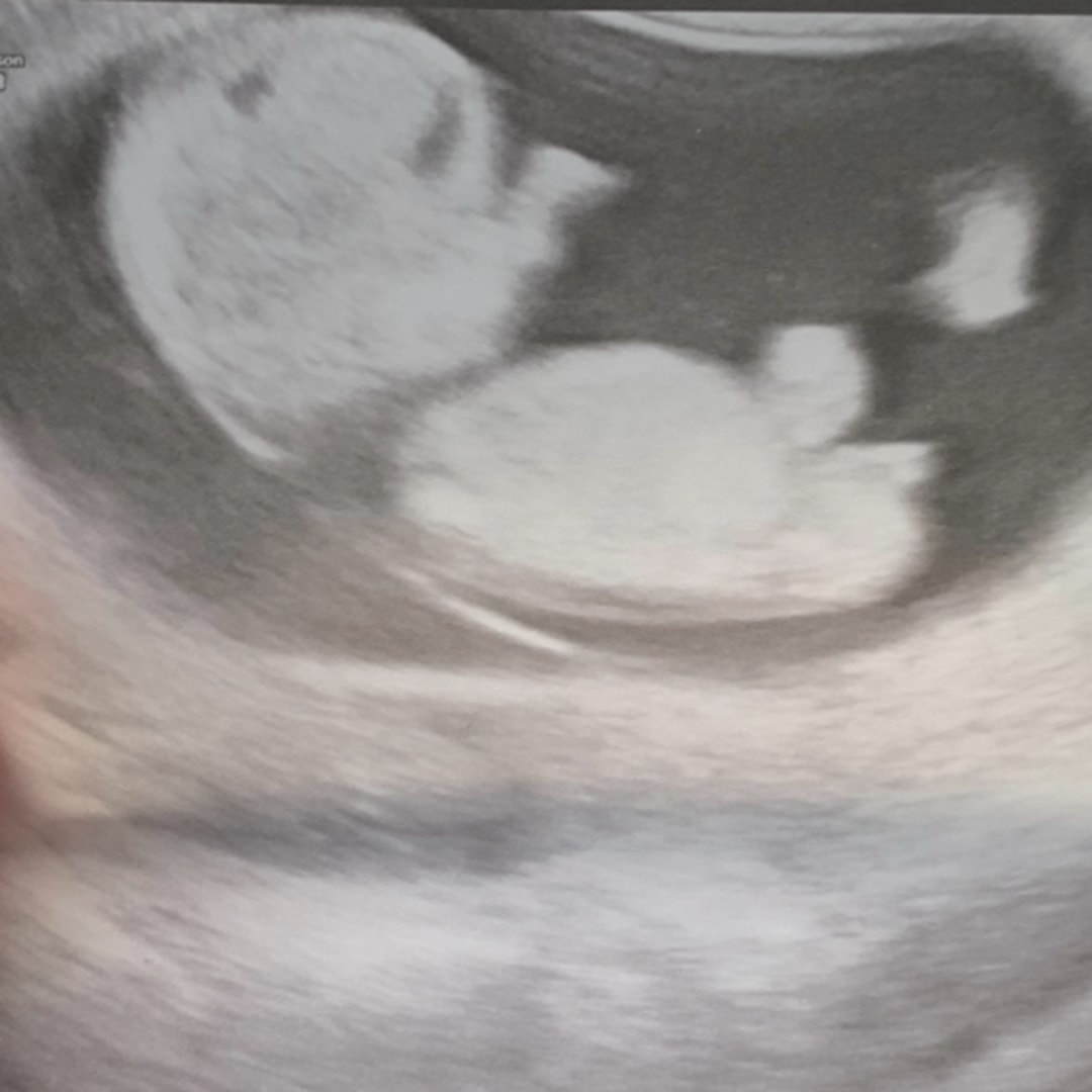 Photo shared by Mollie for their Babylist baby registry.