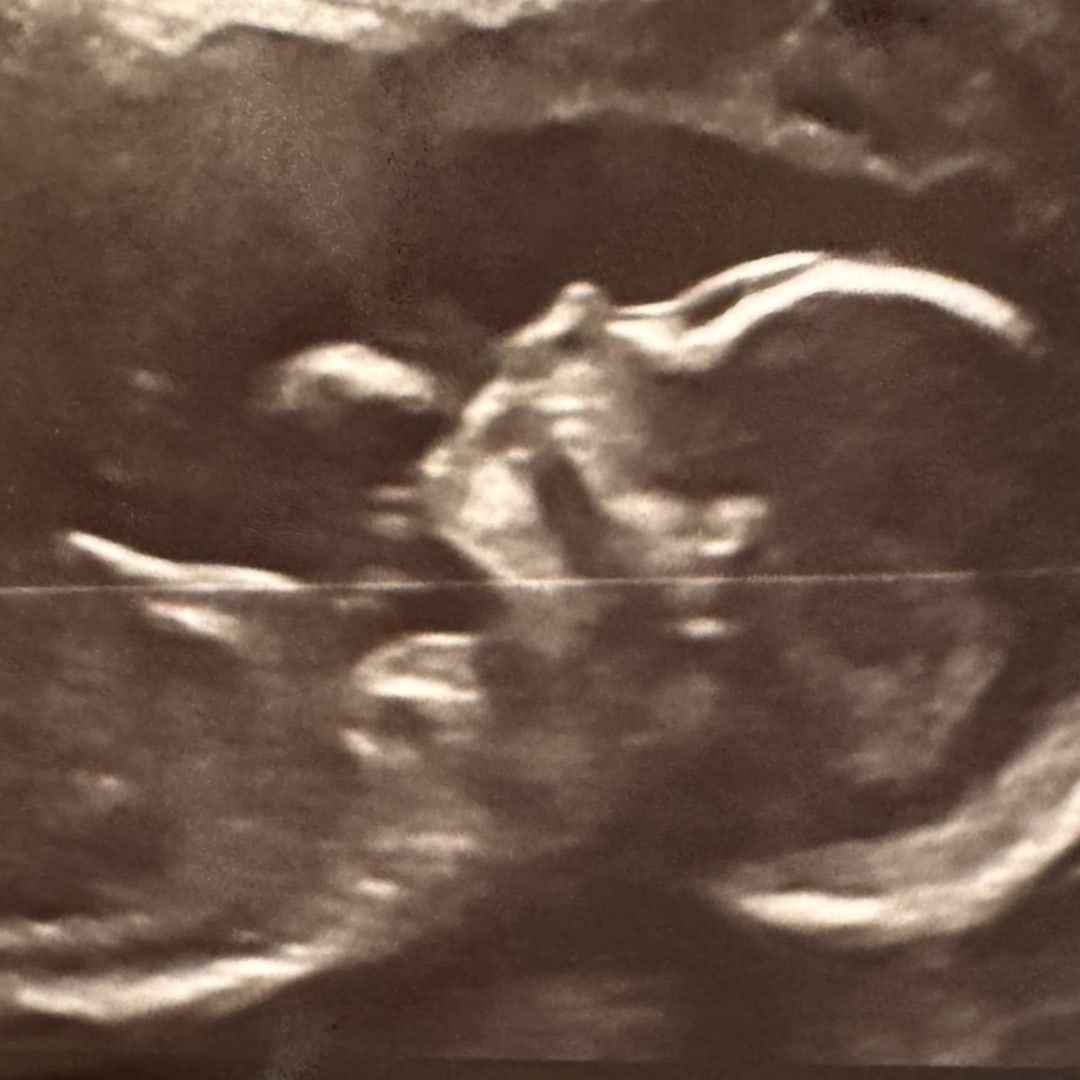 Photo shared by Alexandria for their Babylist baby registry.