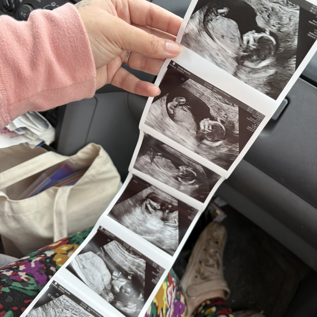 Photo shared by Samantha for their Babylist baby registry.