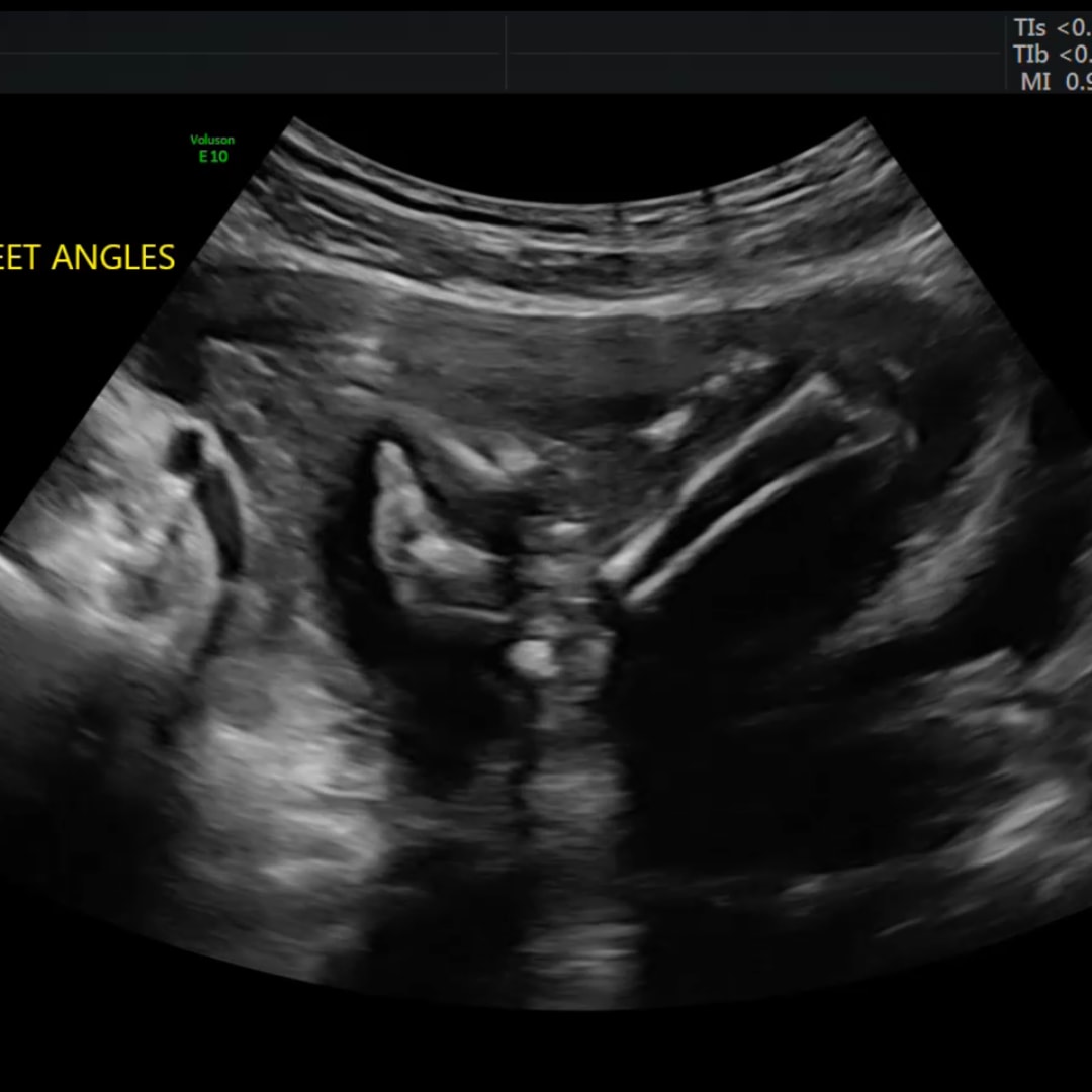 Photo shared by Tre & Kae for their Babylist baby registry.