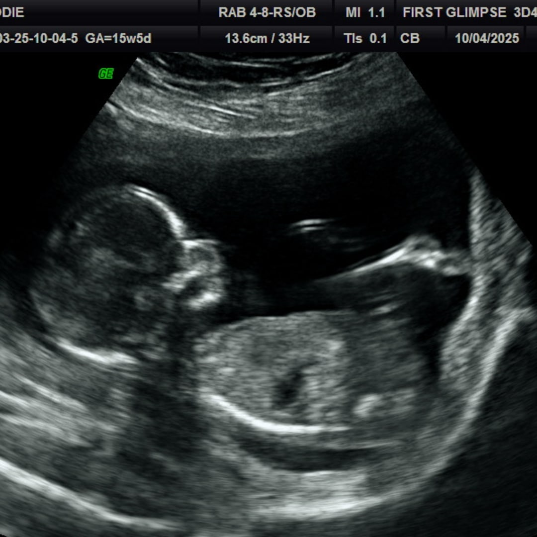 Photo shared by Brodie for their Babylist baby registry.