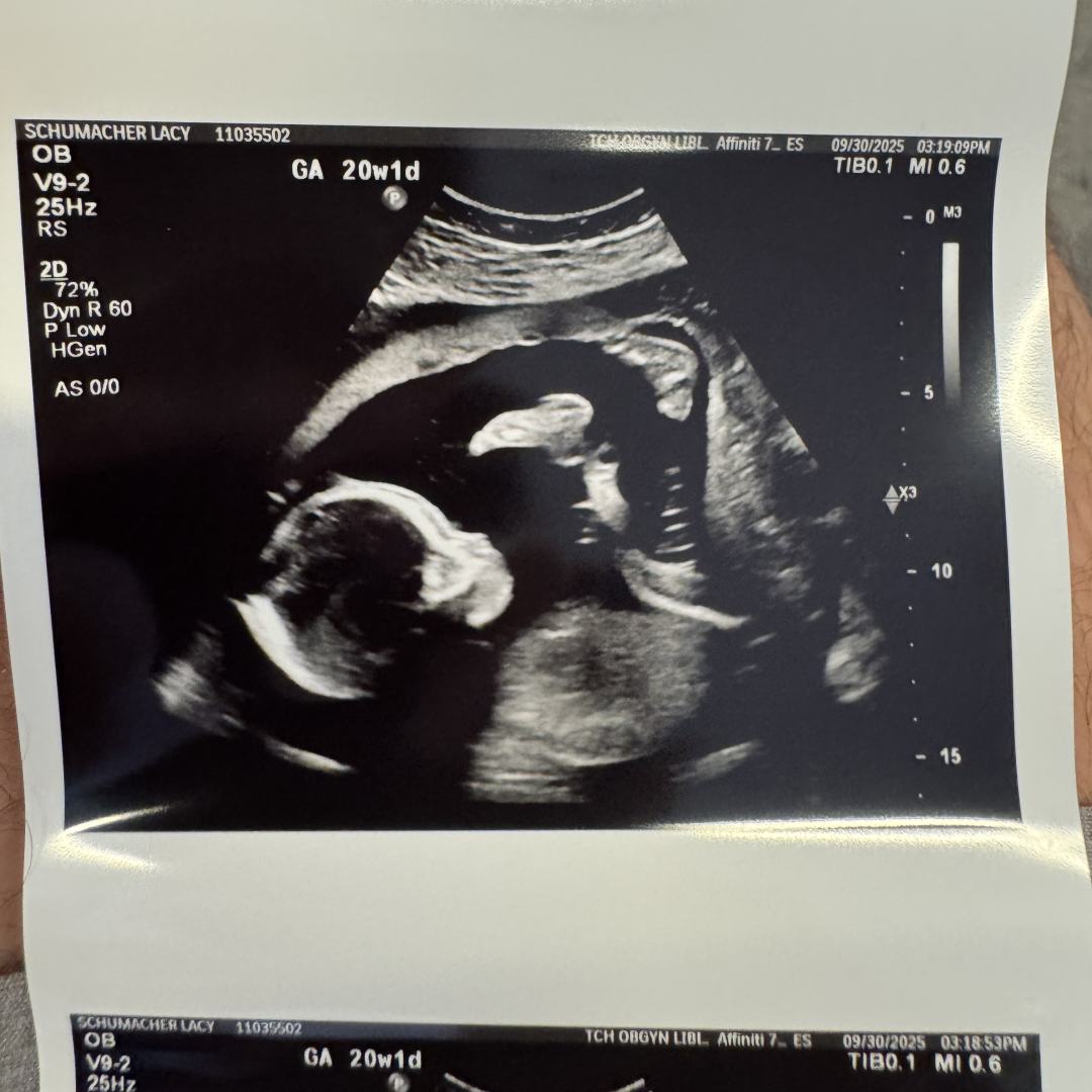Photo shared by Lacy for their Babylist baby registry.