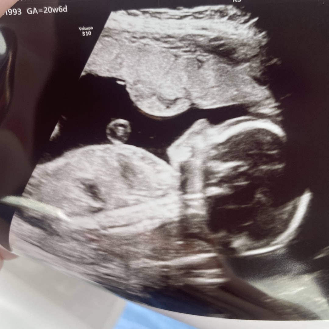 Photo shared by Whitney for their Babylist baby registry.