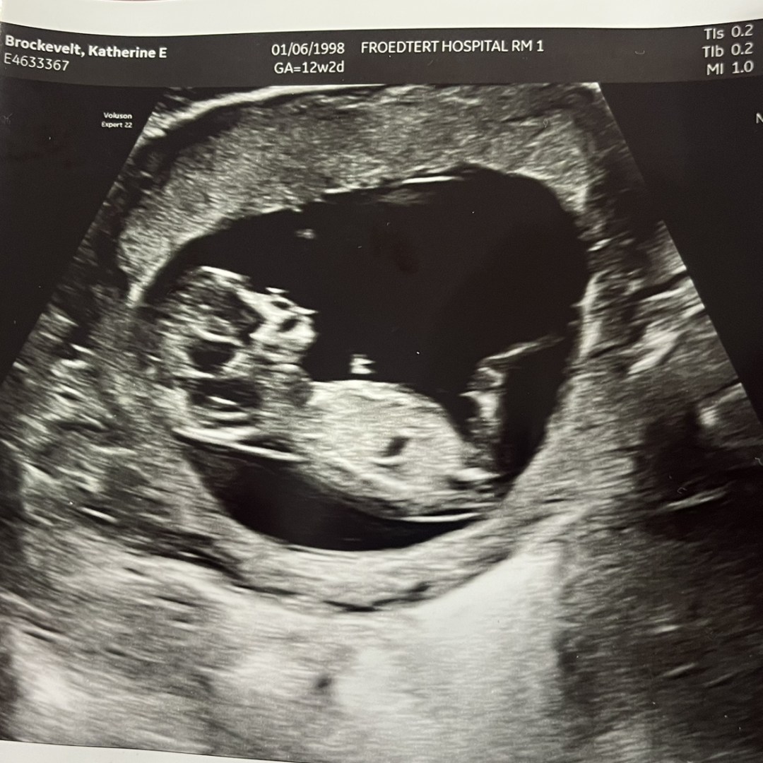 Photo shared by Kate for their Babylist baby registry.