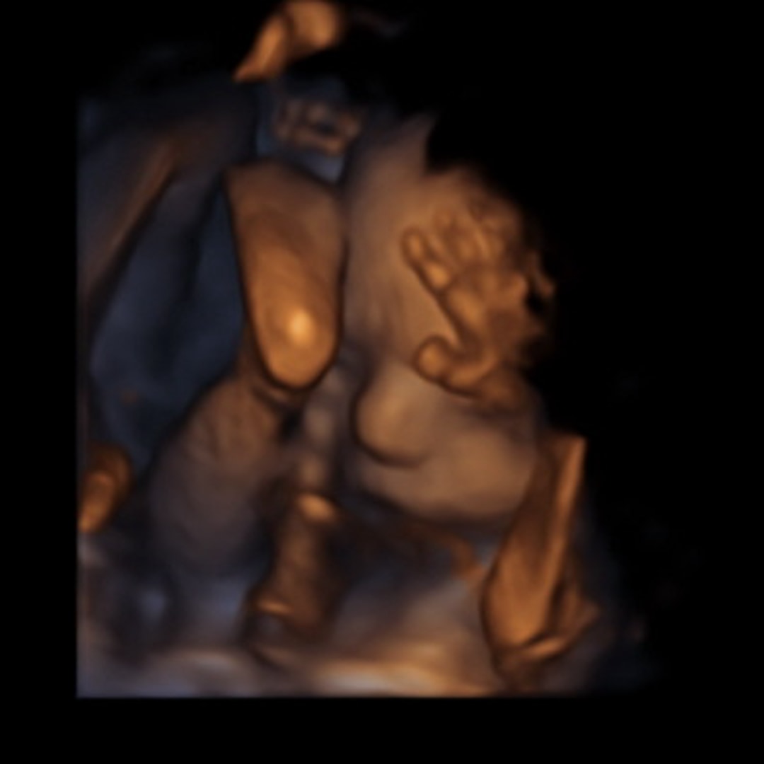 Photo shared by Kaylee for their Babylist baby registry.