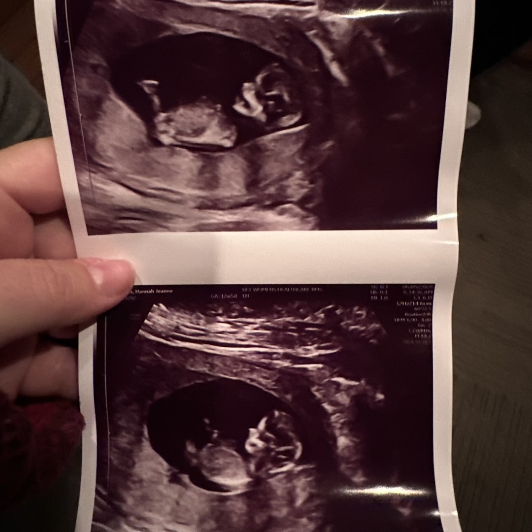 Photo shared by Hannah for their Babylist baby registry.