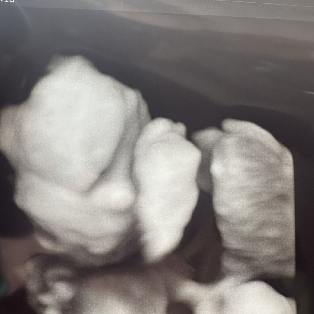 Photo shared by Amy-Beth for their Babylist baby registry.