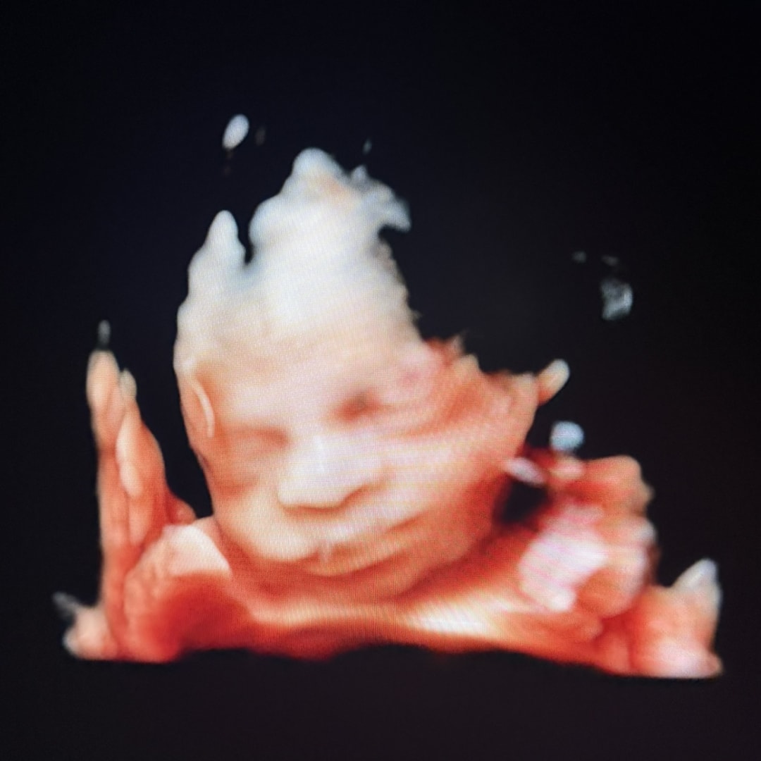 Photo shared by Julia for their Babylist baby registry.