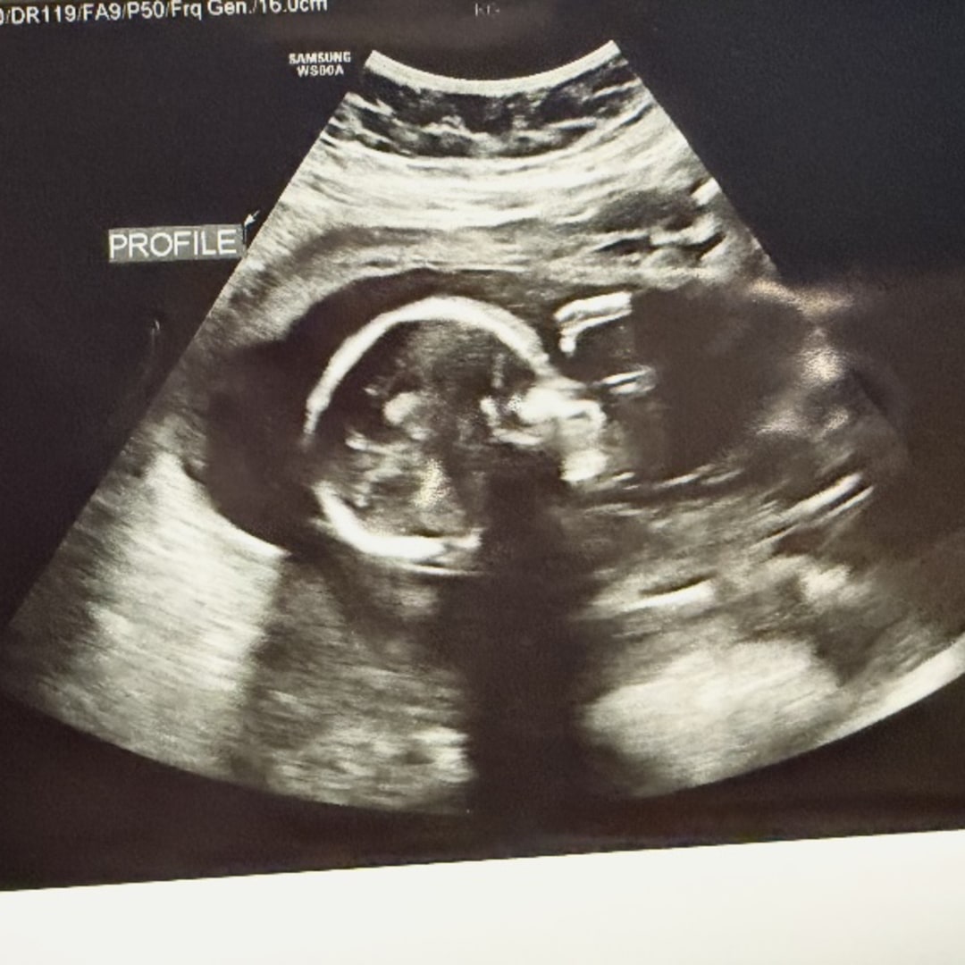 Photo shared by Sarah for their Babylist baby registry.