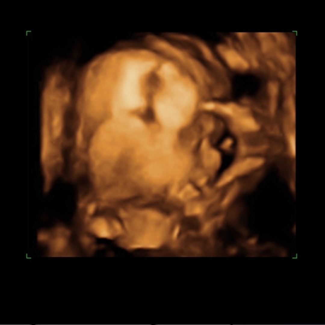 Photo shared by Stefany for their Babylist baby registry.