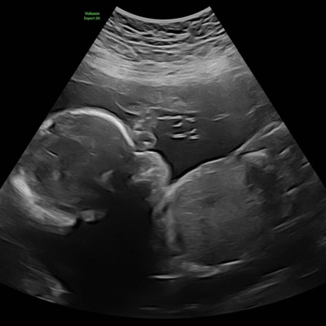 Photo shared by Cynthia for their Babylist baby registry.